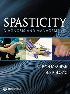 cover image of Spasticity